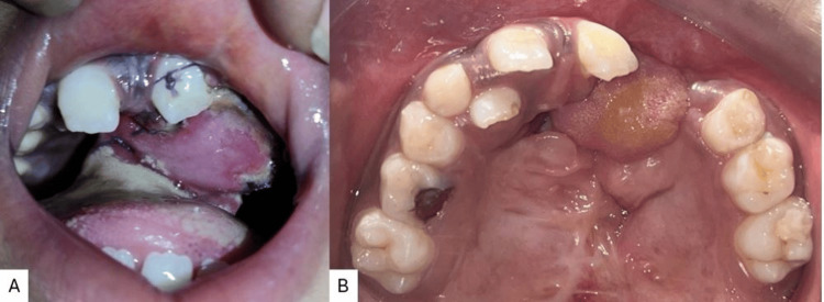 Figure 9