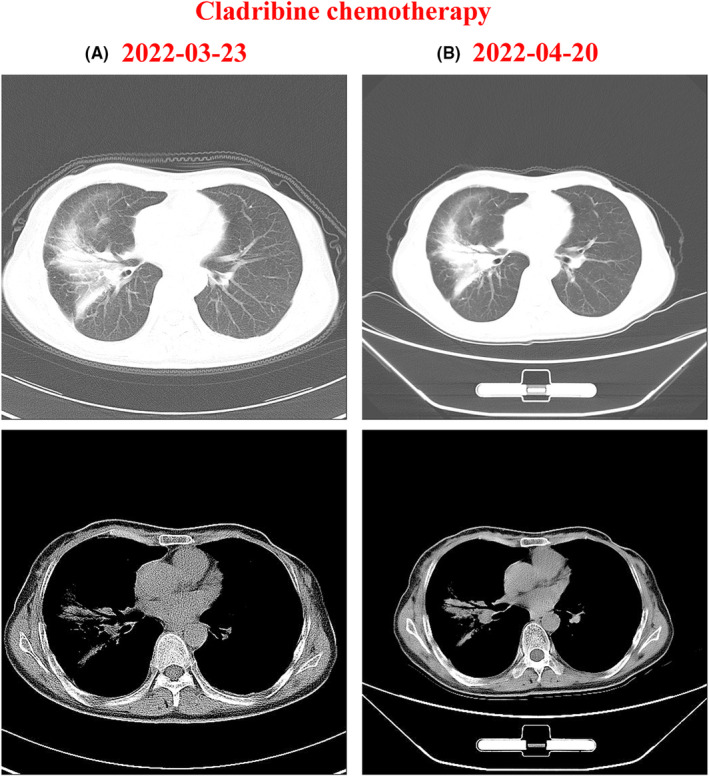 FIGURE 4