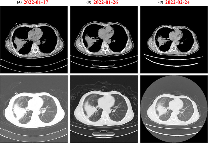FIGURE 2