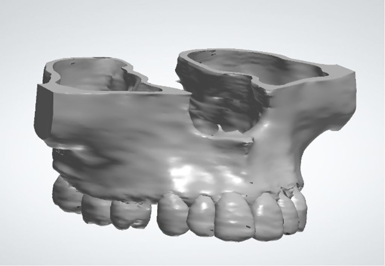 Fig 2