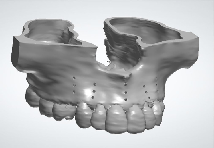 Fig 3