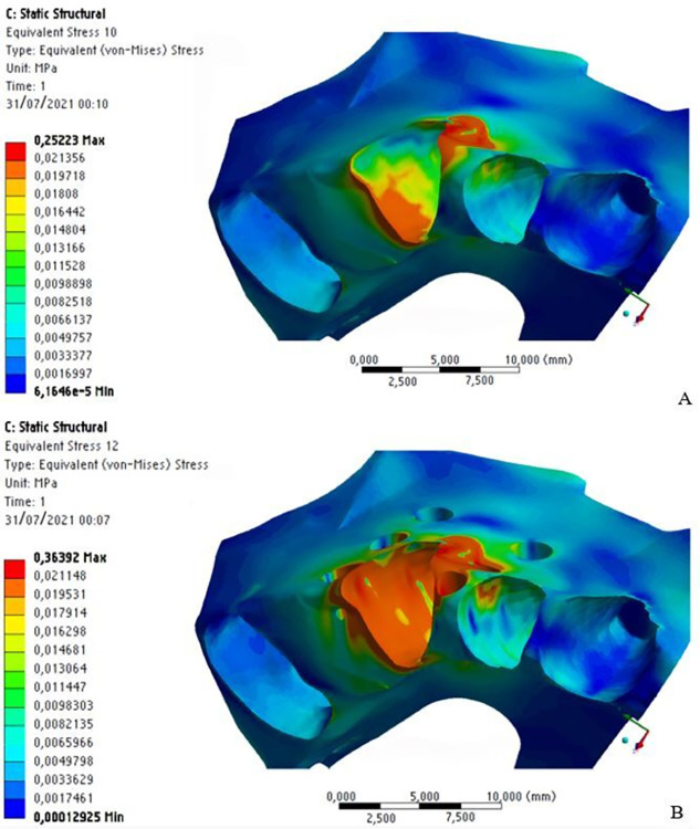 Fig 13