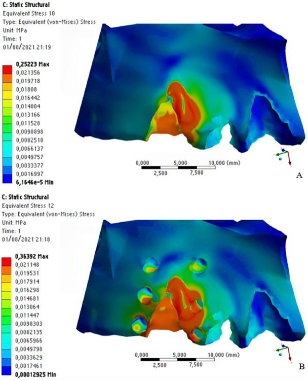 Fig 14