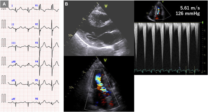FIGURE 1