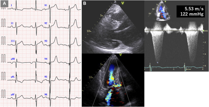 FIGURE 3