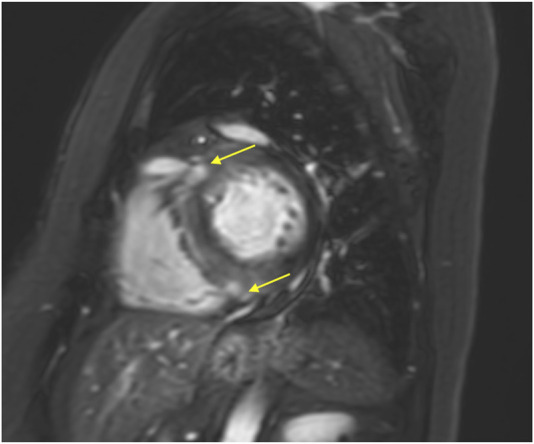 FIGURE 4