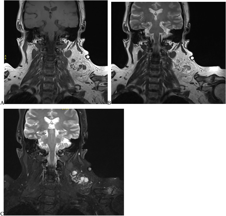 Figure 1