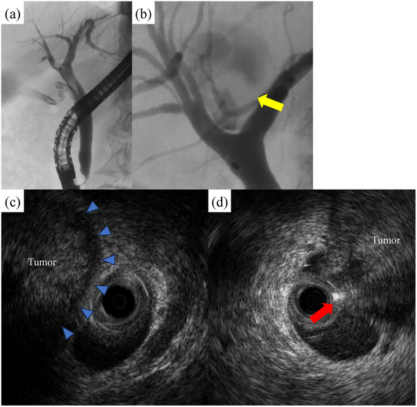 FIGURE 2