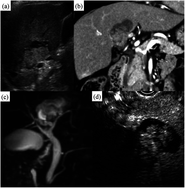 FIGURE 1