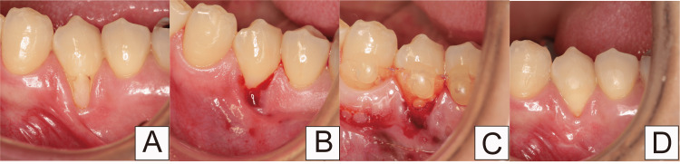 Figure 11