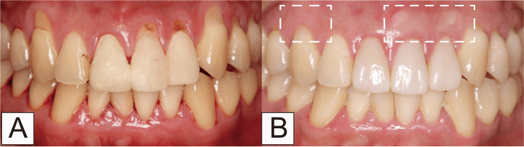 Figure 12
