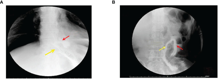 Figure 3