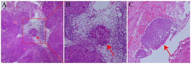 Figure 2