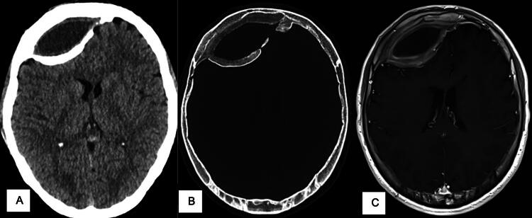 FIG. 1