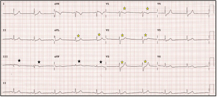 Figure 16
