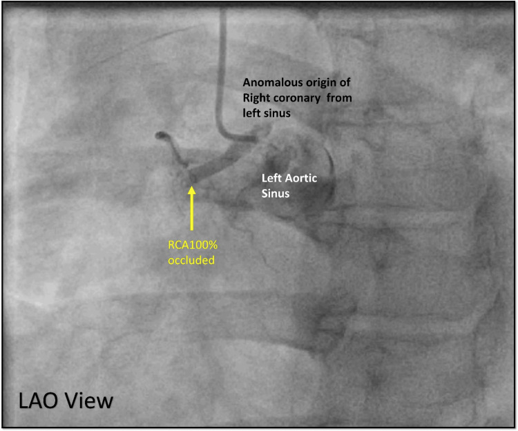Figure 19