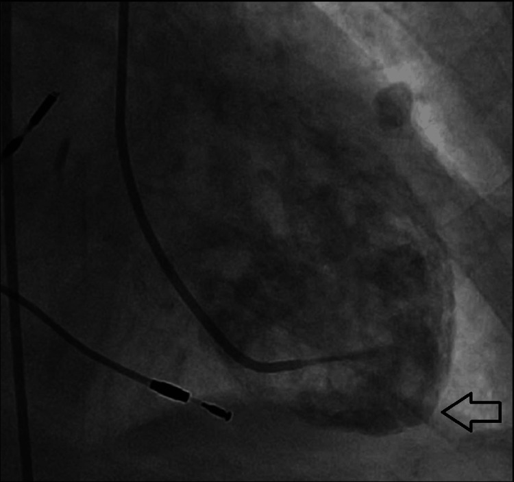 Figure 9