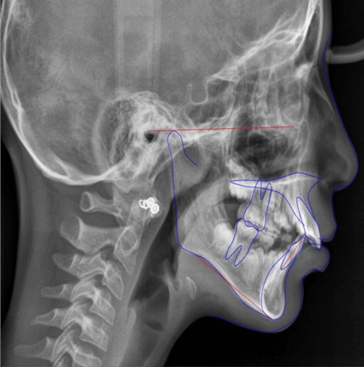 Figure 6