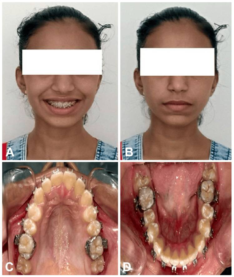 Figure 11