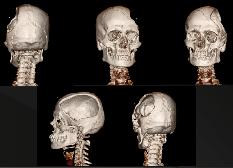 Figure 2