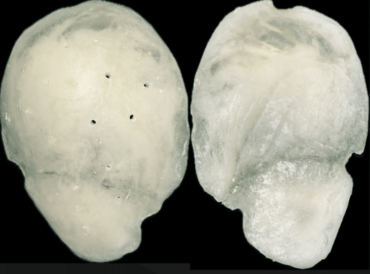 Figure 7