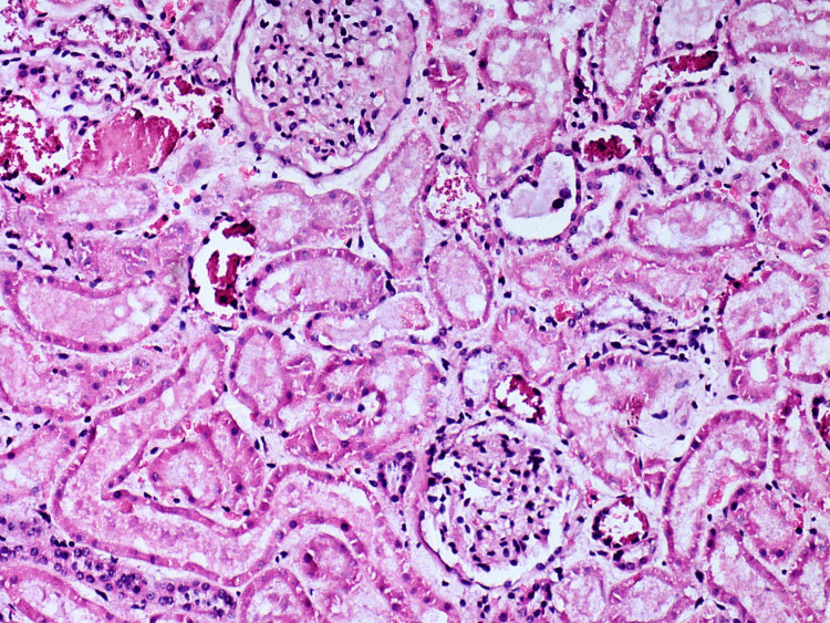 Figure 12