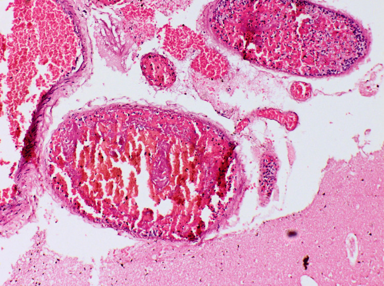 Figure 14