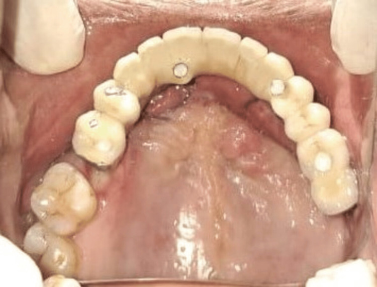 Figure 6