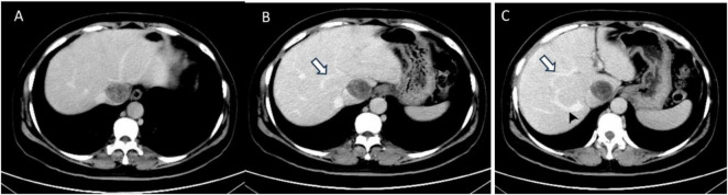 FIGURE 2