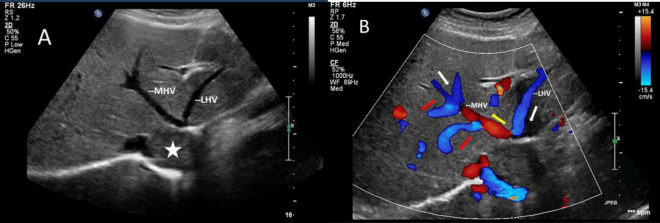 FIGURE 4