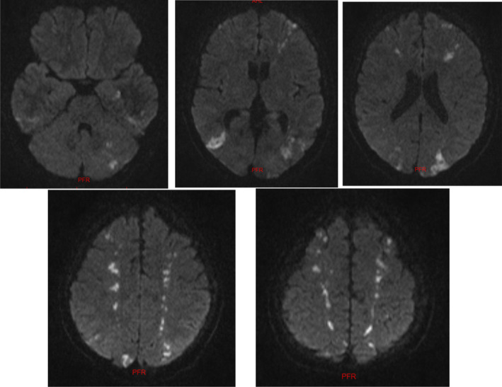 FIGURE 1