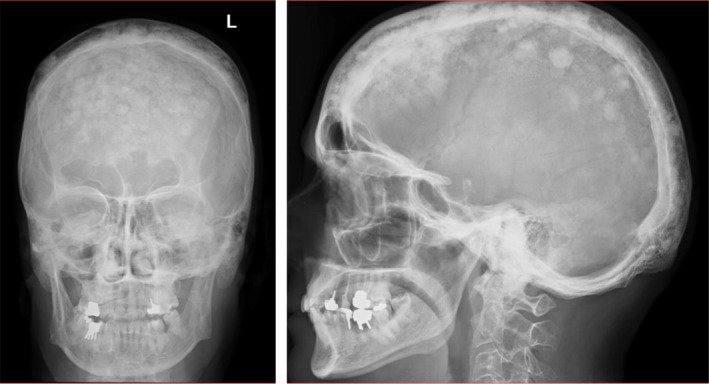 FIGURE 4