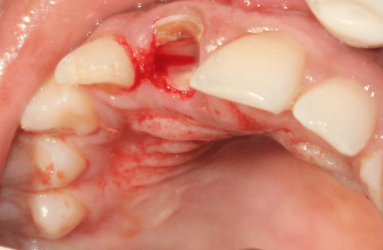 Figure 9