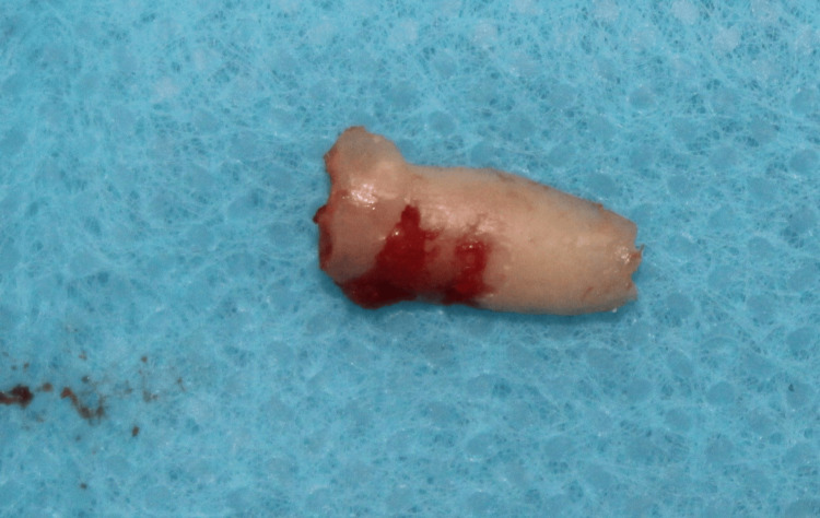 Figure 11