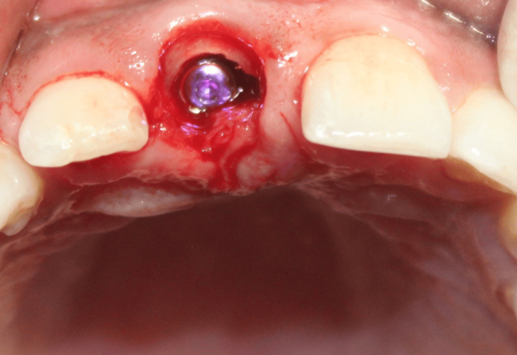 Figure 13