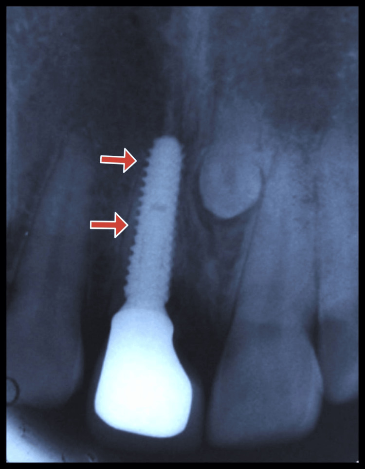 Figure 16