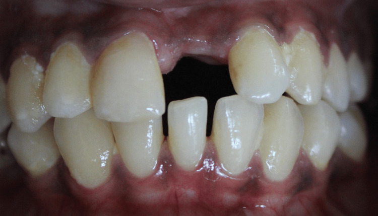 Figure 17