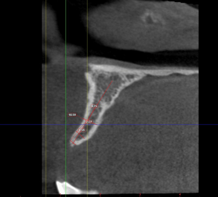 Figure 18