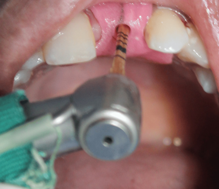 Figure 19