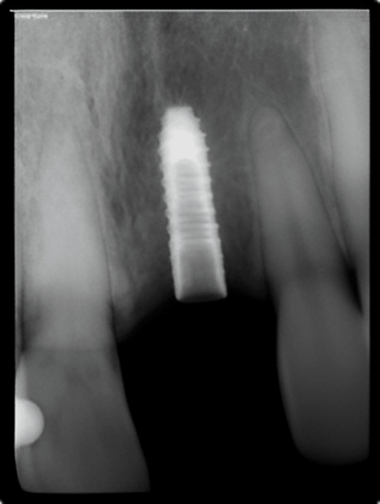 Figure 21