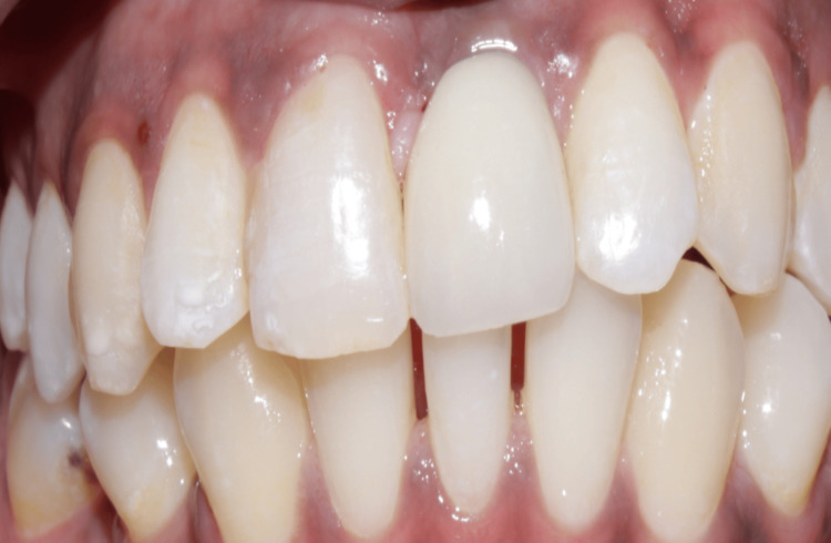 Figure 22