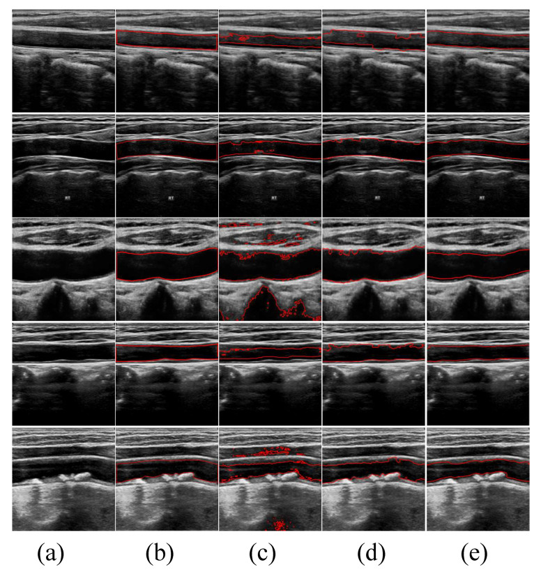 Figure 4
