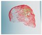 Figure 45