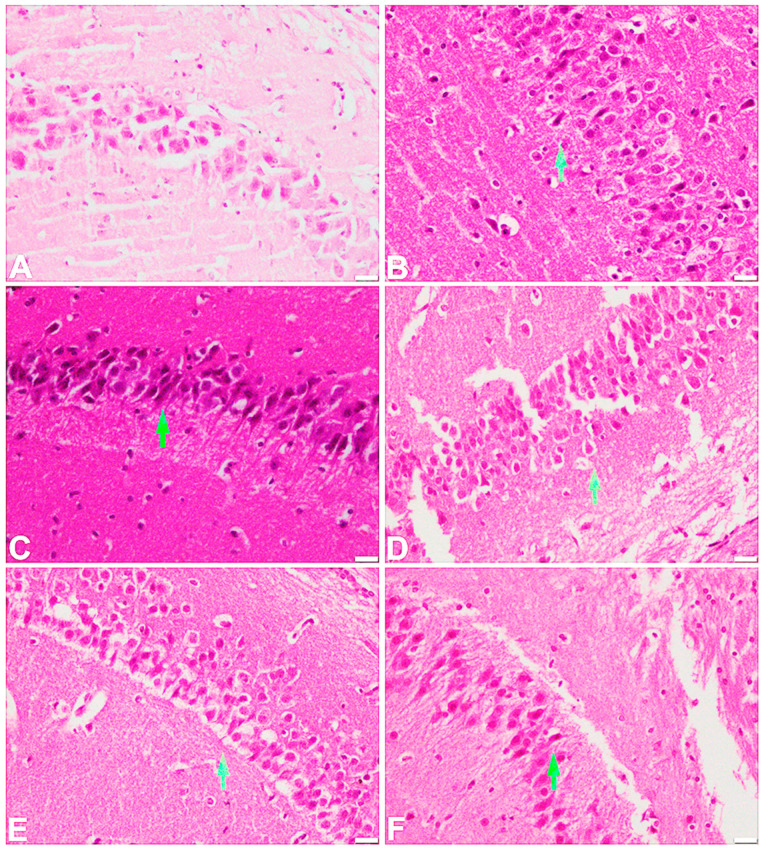 Figure 10