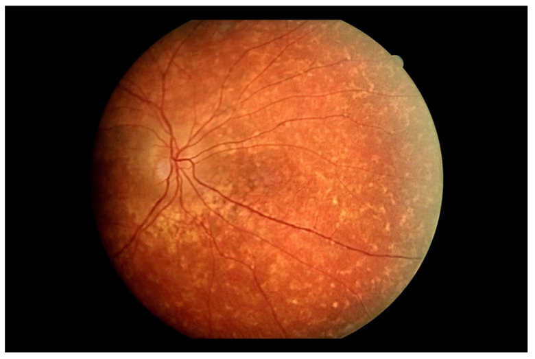 Figure 10