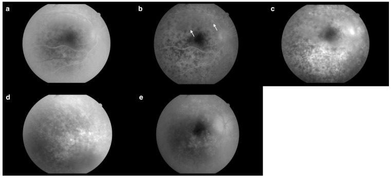 Figure 11