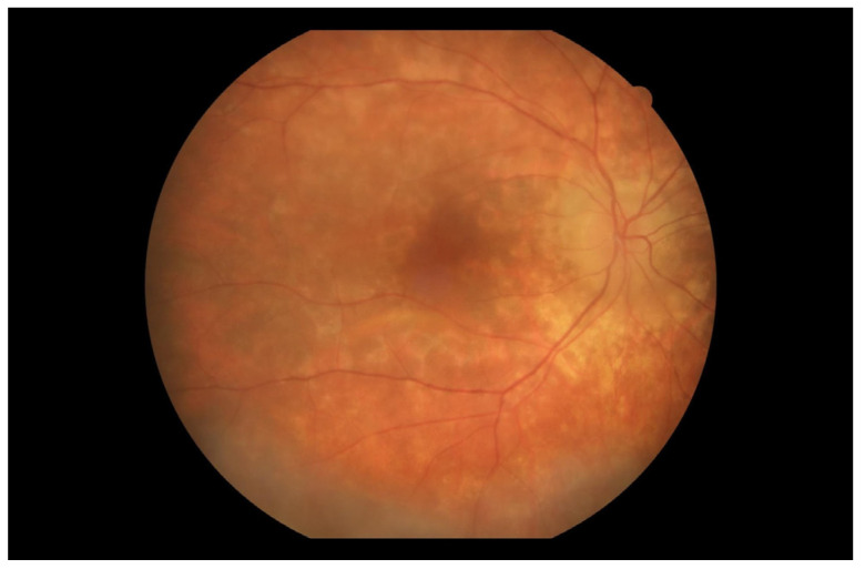 Figure 12