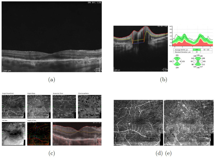 Figure 13