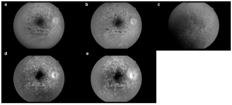Figure 14