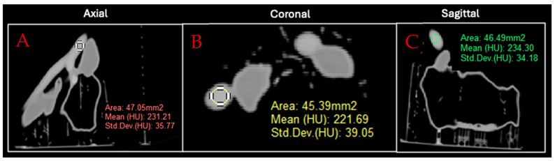 Figure 5